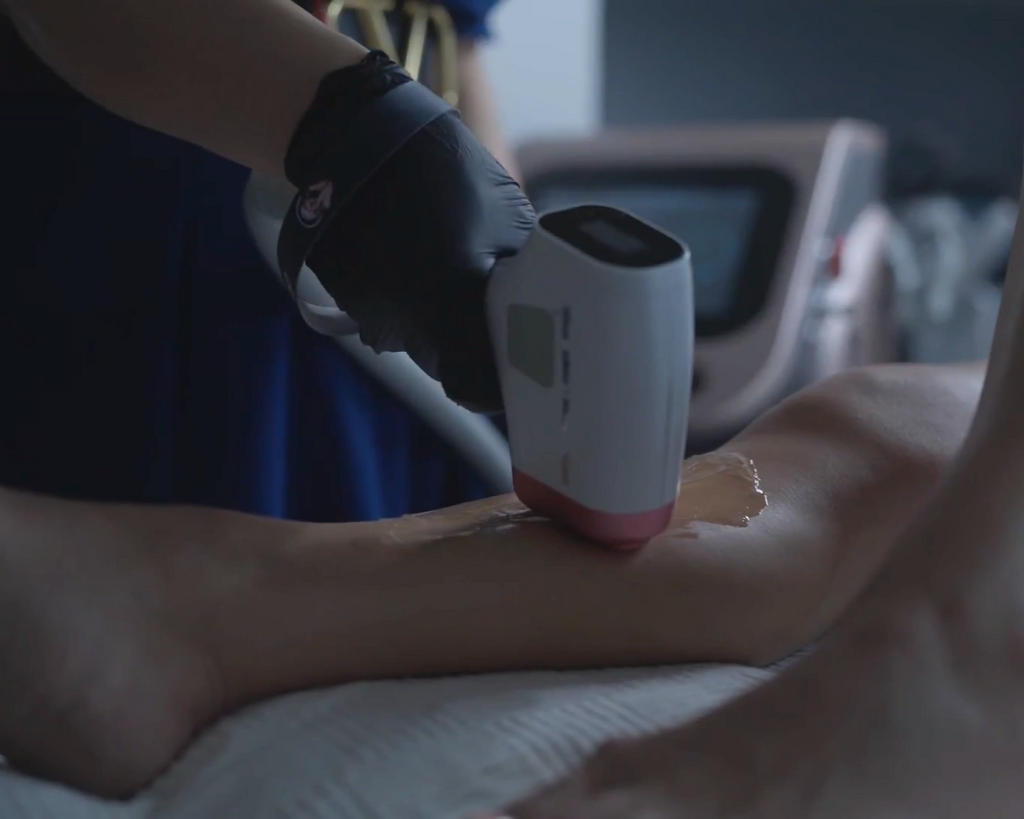 Eine Kundin kriegt dauerhafte Haarentfernung mit Laser im Kosmetikstudio